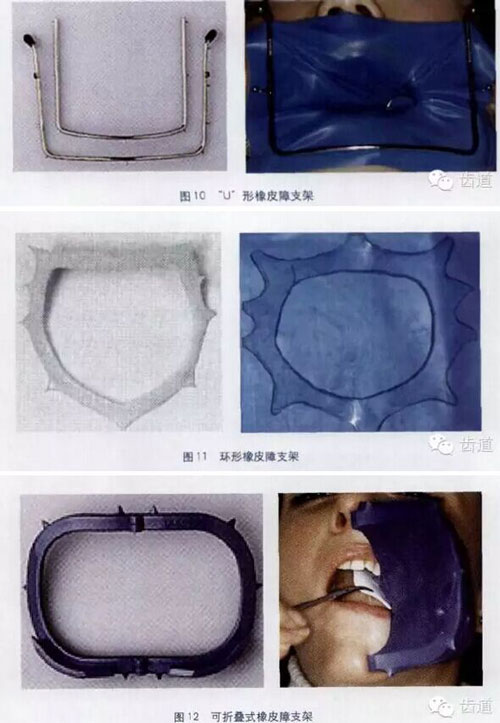 橡皮障的臨床運用大全 橡皮障的臨床運用大全