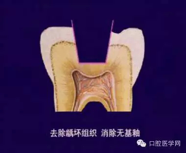 640.webp.jpg 640.webp.jpg