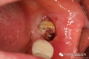 640.webp-(9).jpg 640.webp-(9).jpg