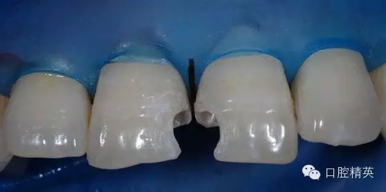 5.webp.jpg 5.webp.jpg