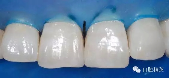 15.webp.jpg 15.webp.jpg