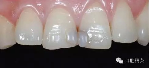 20.webp.jpg 20.webp.jpg