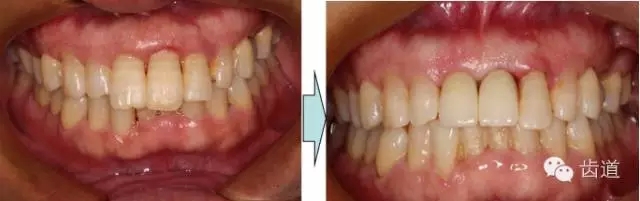 29.webp.jpg 29.webp.jpg