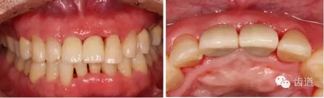 31.webp.jpg 31.webp.jpg