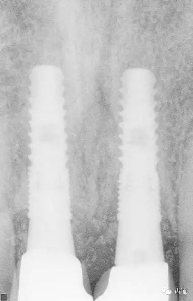 32.webp.jpg 32.webp.jpg