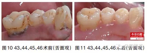 5.webp.jpg 5.webp.jpg