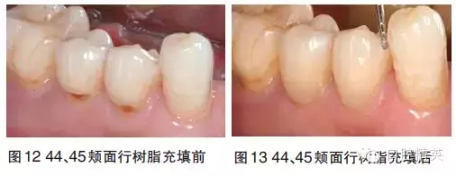 6.webp.jpg 6.webp.jpg