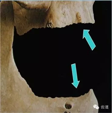 1.webp.jpg 1.webp.jpg