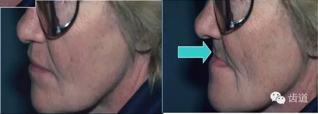 6.webp.jpg 6.webp.jpg