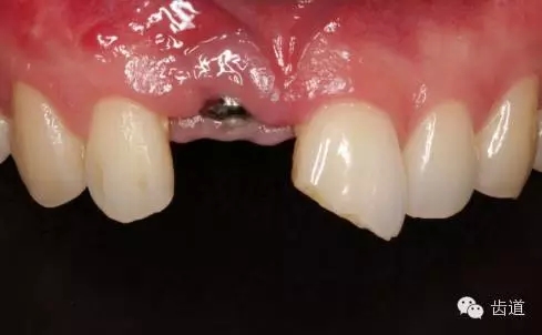 1.webp.jpg 1.webp.jpg