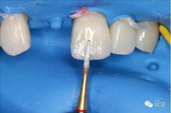 32.webp.jpg 32.webp.jpg