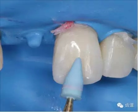 33.webp.jpg 33.webp.jpg