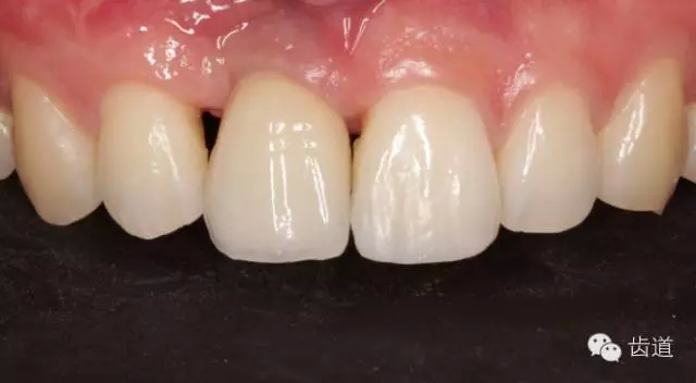 44.webp.jpg 44.webp.jpg