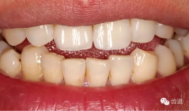 46.webp.jpg 46.webp.jpg