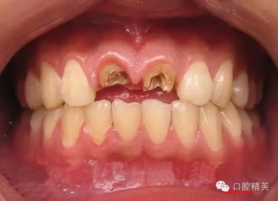 2.webp.jpg 2.webp.jpg