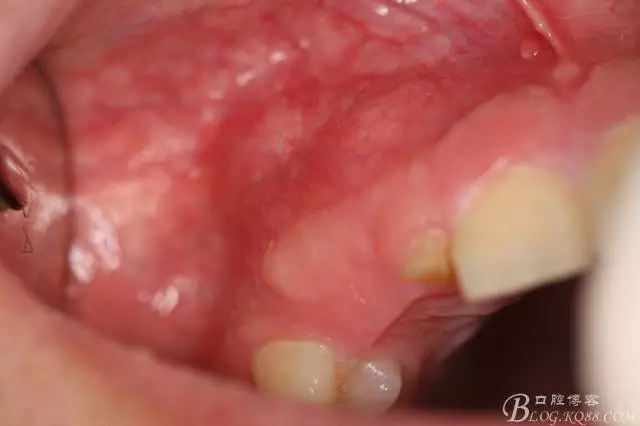 1.webp.jpg 1.webp.jpg