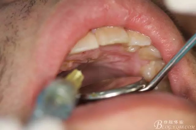 3.webp.jpg 3.webp.jpg