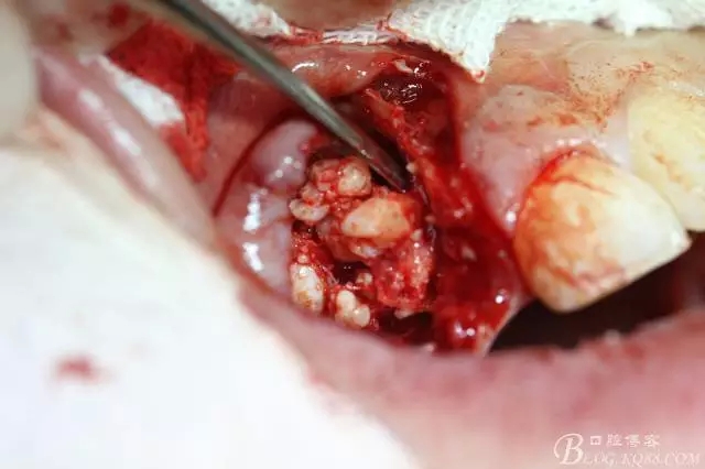 12.webp.jpg 12.webp.jpg