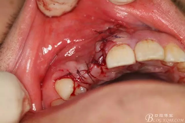 17.webp.jpg 17.webp.jpg