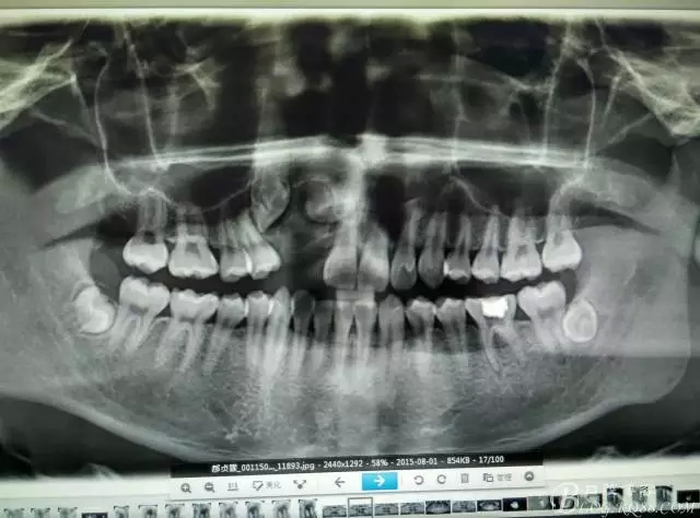 18.webp.jpg 18.webp.jpg