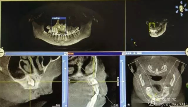 2.webp.jpg 2.webp.jpg