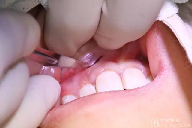 3.webp.jpg 3.webp.jpg