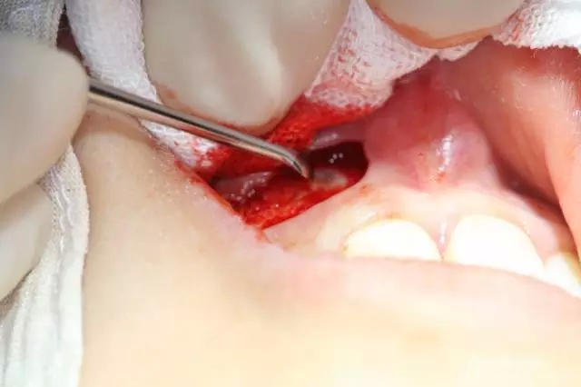 4.webp.jpg 4.webp.jpg