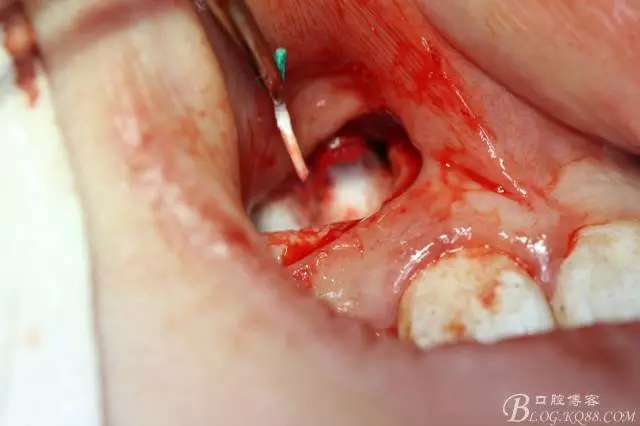 14.webp.jpg 14.webp.jpg