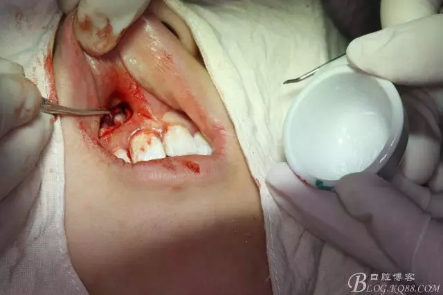 15.webp.jpg 15.webp.jpg