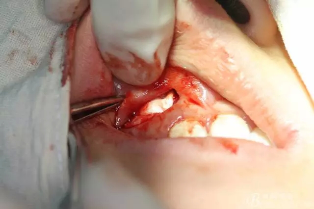 16.webp.jpg 16.webp.jpg