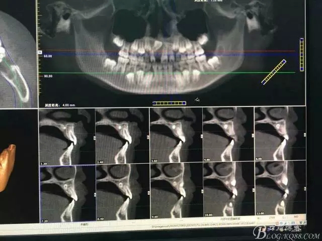 2.webp.jpg 2.webp.jpg