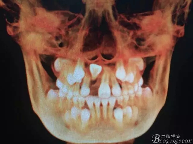 4.webp.jpg 4.webp.jpg