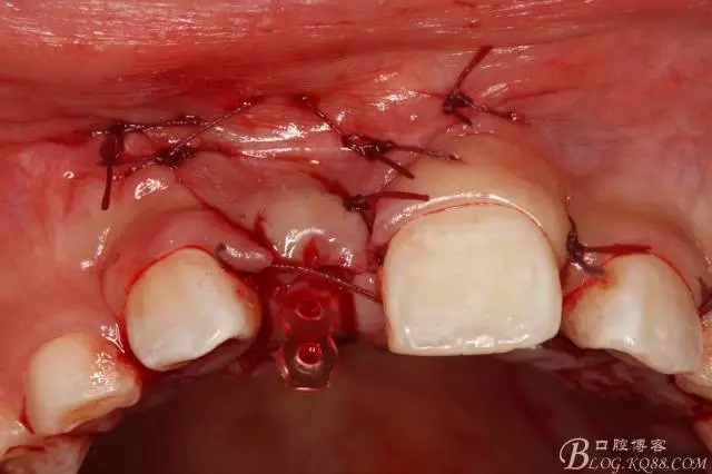 15.webp.jpg 15.webp.jpg