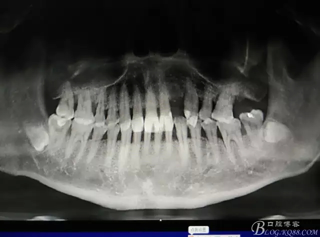 1.webp.jpg 1.webp.jpg