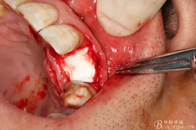 11.webp.jpg 11.webp.jpg