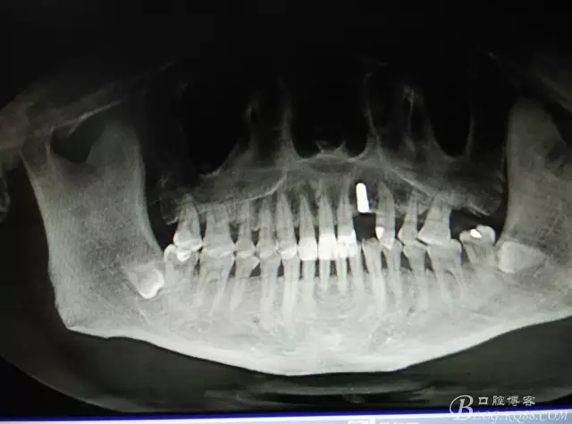 14.webp.jpg 14.webp.jpg