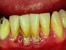 圖片11.png 圖片11.png