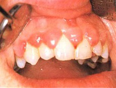 圖片12.png 圖片12.png