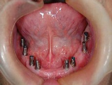 圖片13.png 圖片13.png