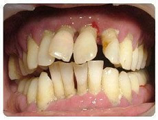 圖片14.png 圖片14.png