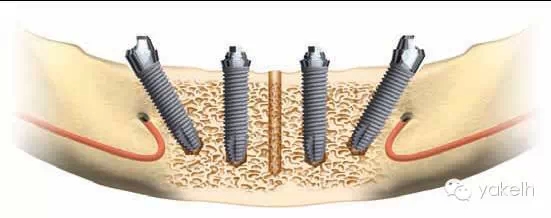 2.webp.jpg 2.webp.jpg