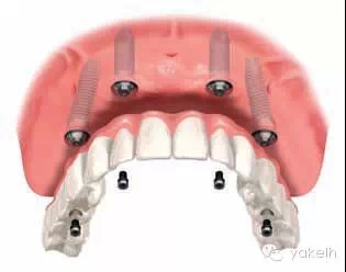 3.webp.jpg 3.webp.jpg