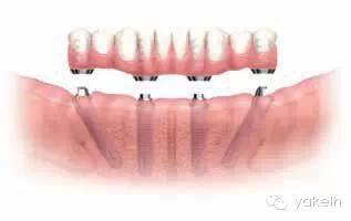 4.webp.jpg 4.webp.jpg