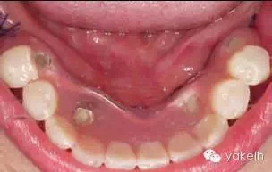 6.webp.jpg 6.webp.jpg