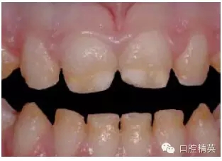 6.webp.jpg 6.webp.jpg