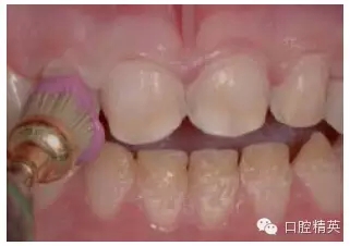 11.webp.jpg 11.webp.jpg