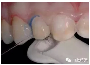 19.webp.jpg 19.webp.jpg