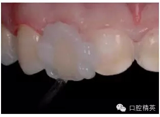 30.webp.jpg 30.webp.jpg