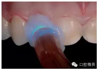 31.webp.jpg 31.webp.jpg