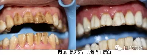 640.webp (10).jpg 640.webp (10).jpg